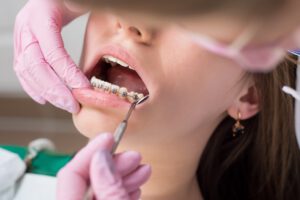 Clínica dental en Rocafort - dientes de metal