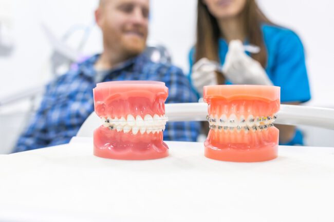 ortodoncia en montcada- cesdental