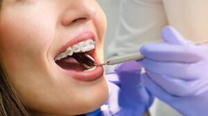 ortodoncia en Montcada - tratamiento