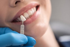 implantes dentales en Burjasot - carillas