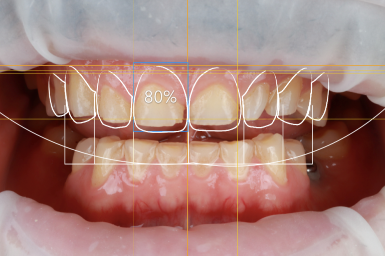 dentistas en Burjassot – simulación dentistas en Burjassot - simulación