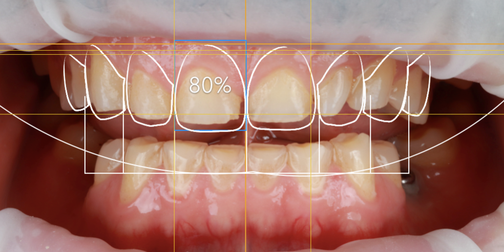 dentistas en Burjassot – simulación dentistas en Burjassot - simulación