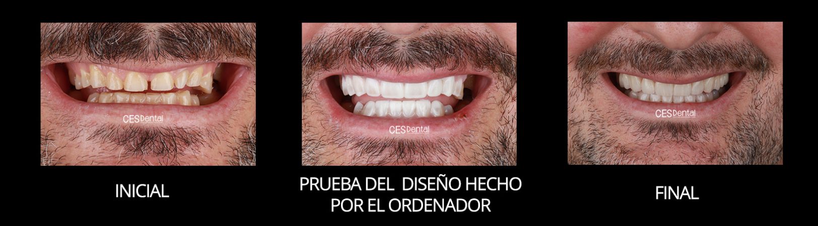 FRONTAL SONRISA
