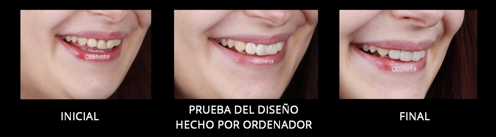 PERFIL DERECHO SONRISA PROFUNDA
