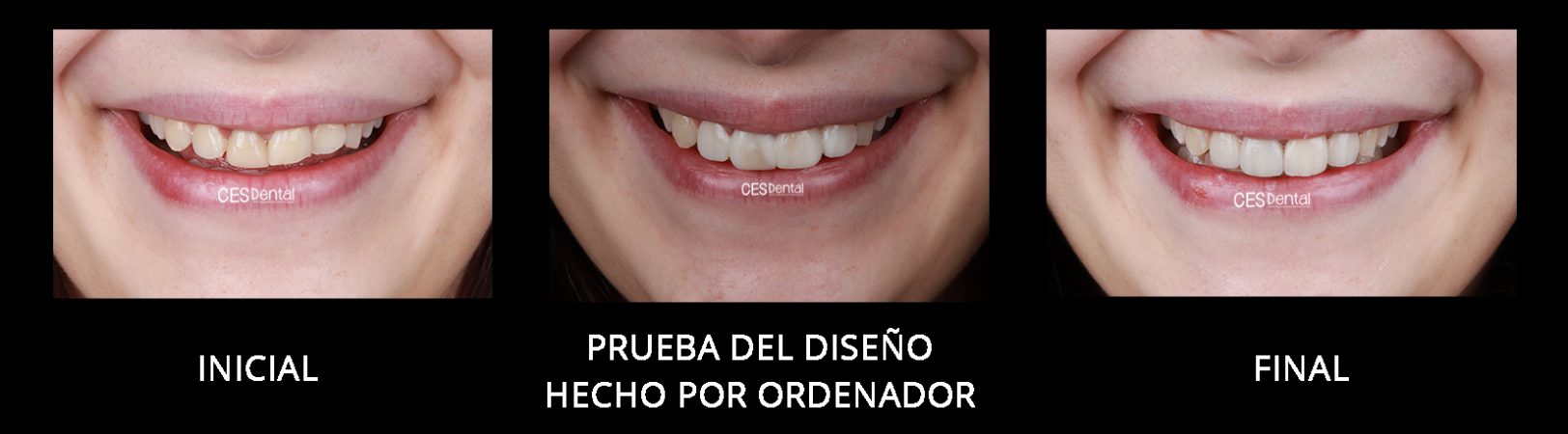 FRONTAL SONRISA