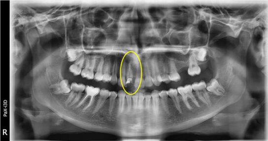 radiografa dental
