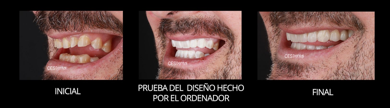 PERFIL I SONRISA
