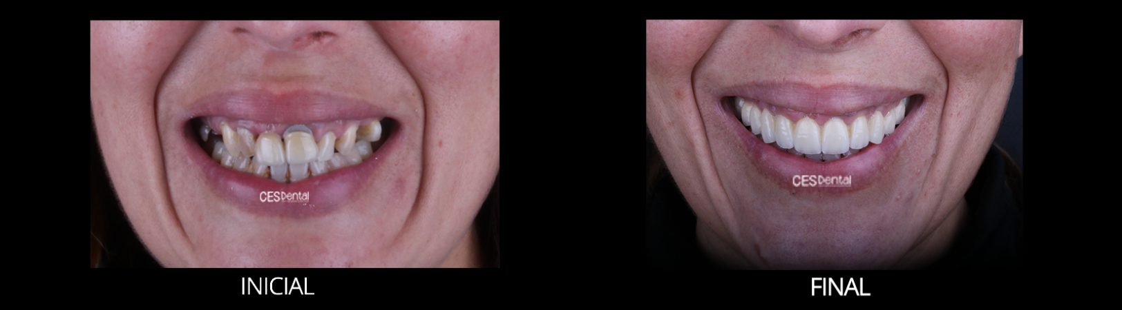 FINAL FRONTAL DETALLE