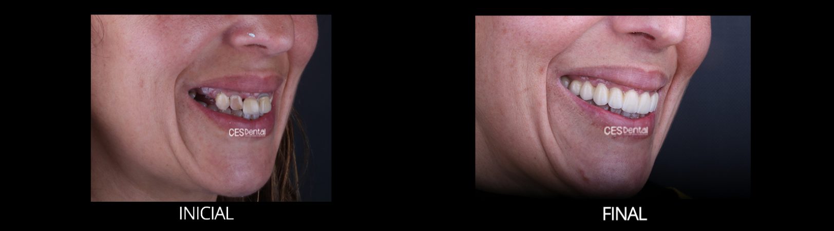 FINAL PERFIL DERECHO DETALLE