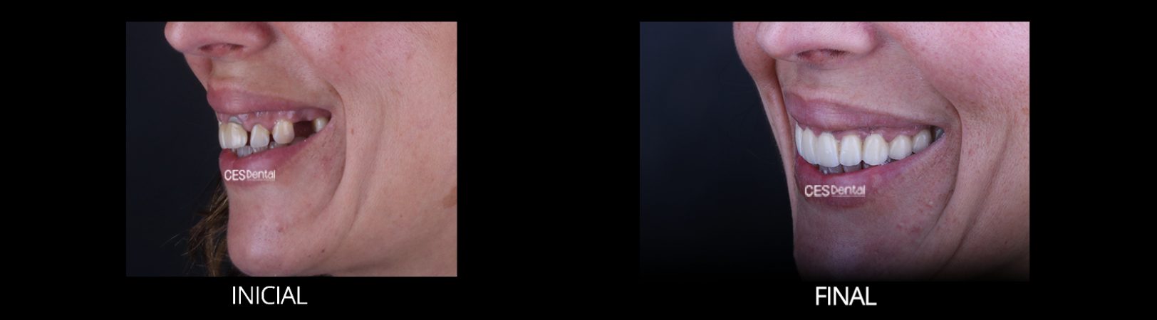 FINAL PERFIL IZQUIERDO DETALLE