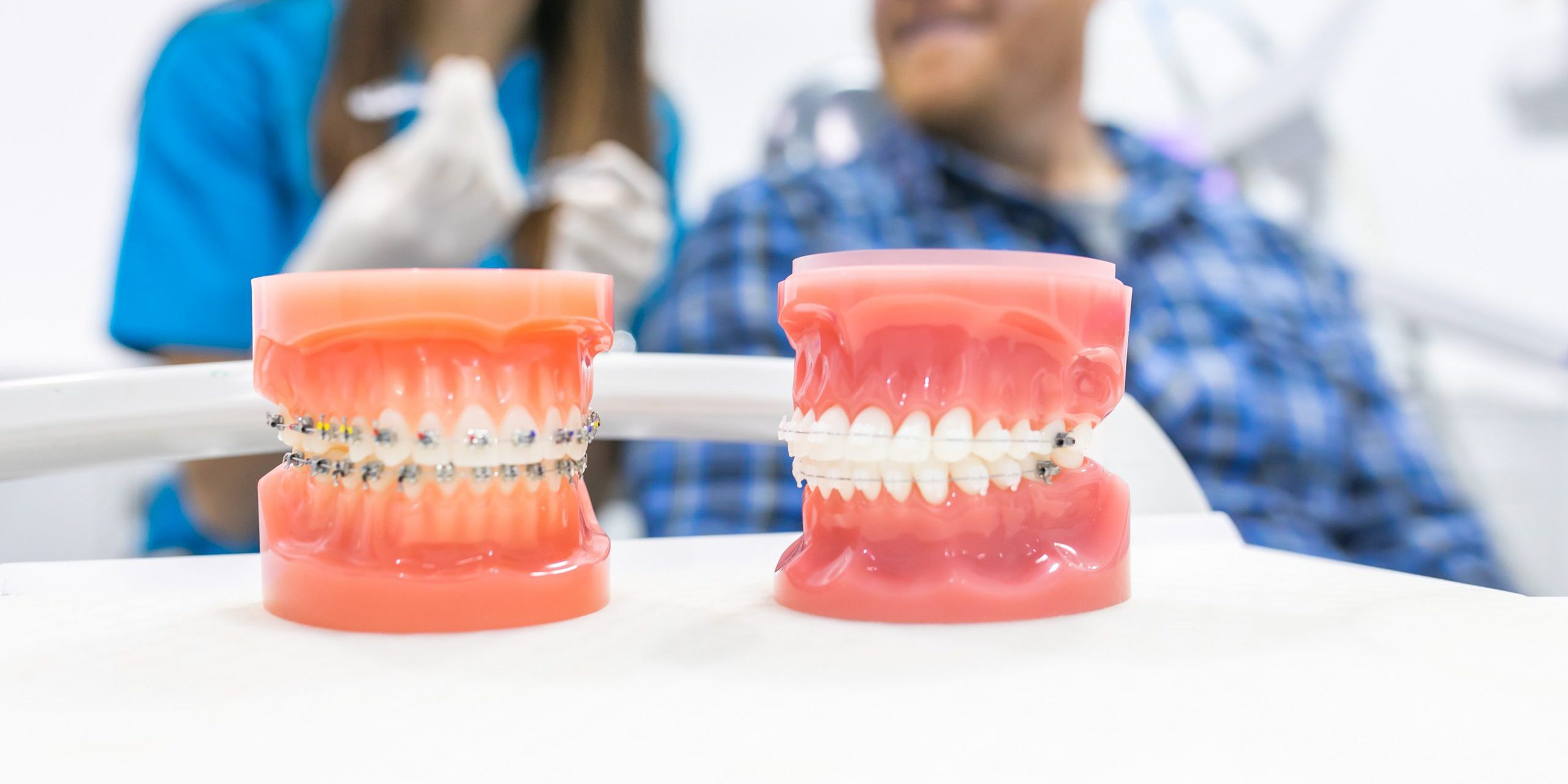 ortodoncia en Burjassot – modelos dentales