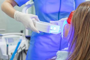 odontología estética en Bujassot - blanqueamiento dental