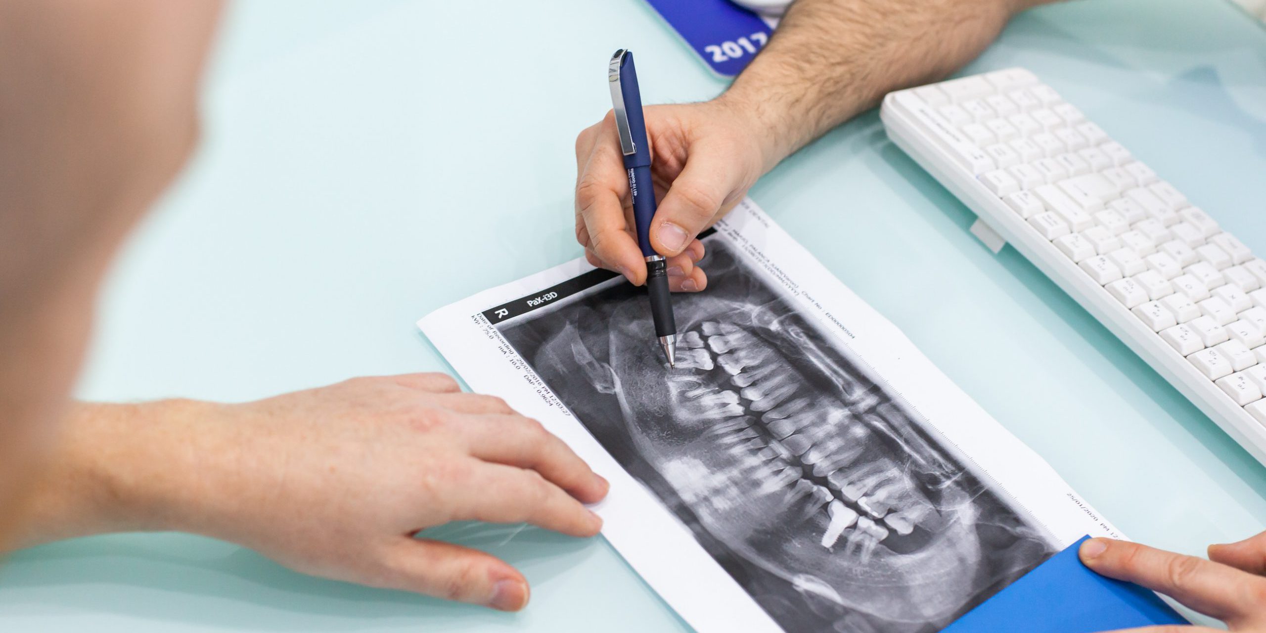 dentista cerca de Burjassot – radiografía dentista cerca de Burjassot - radiografía