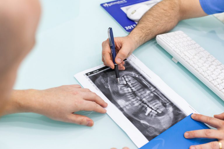 dentista cerca de Burjassot – radiografía dentista cerca de Burjassot - radiografía