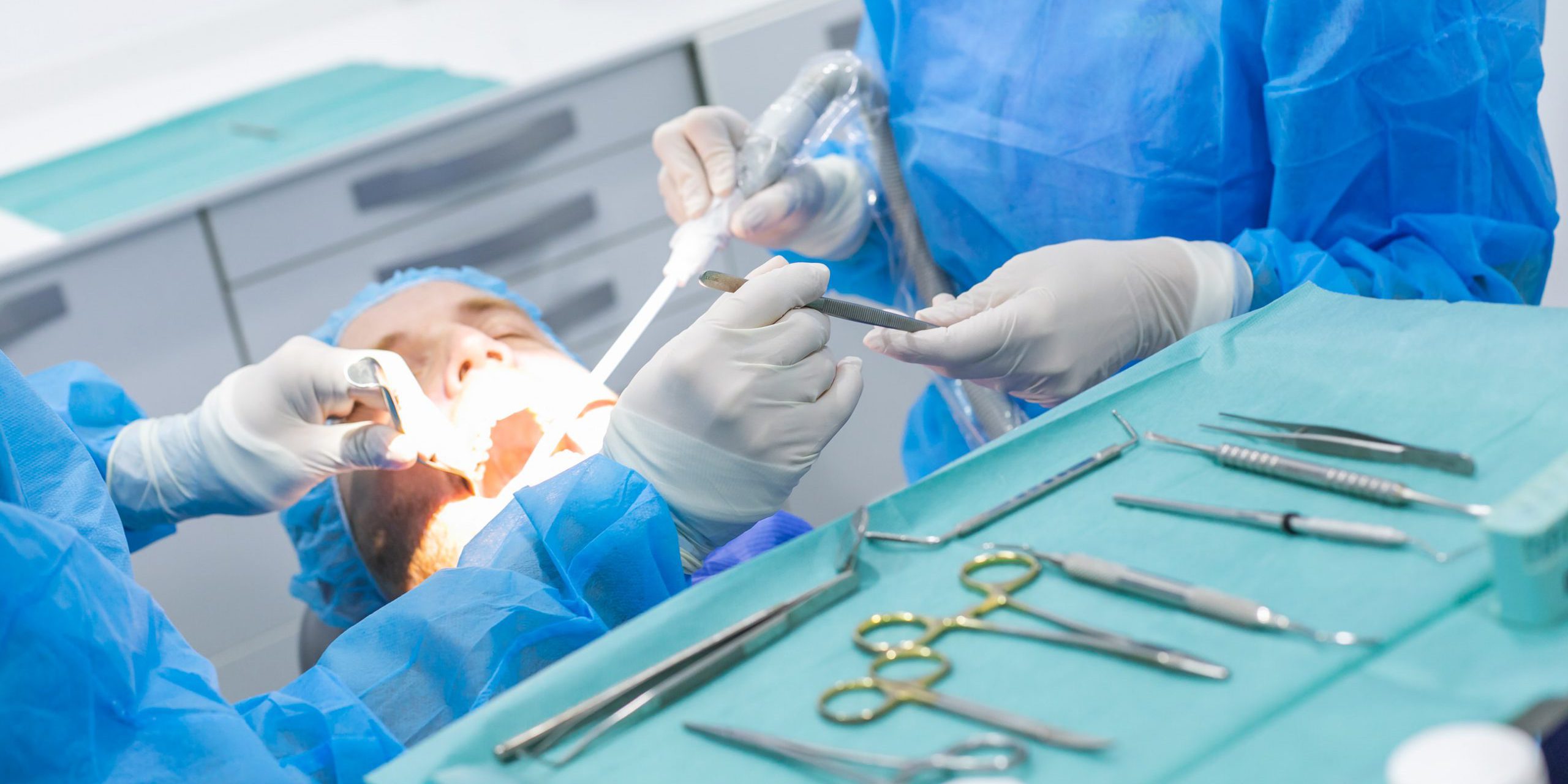 dentista en Burjasot - extraccion de muelas del juicio