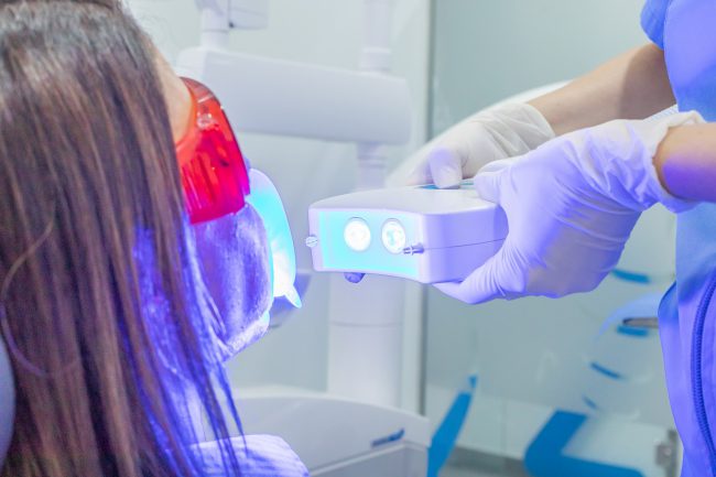 clínicas dentales Burjassot - Blanqueamiento dental