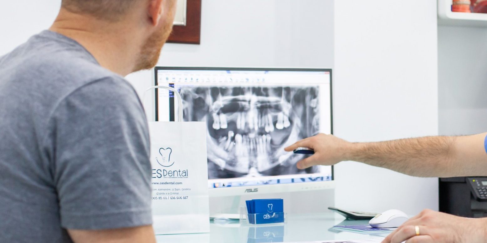 clínica dental en Burjassot - mandíbula