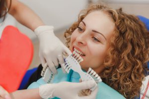 odontologia estética en burjassot - diseño de sonrisa