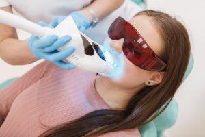 odontología estética en burjassot - mujer realizandose un blanqueamiento dental