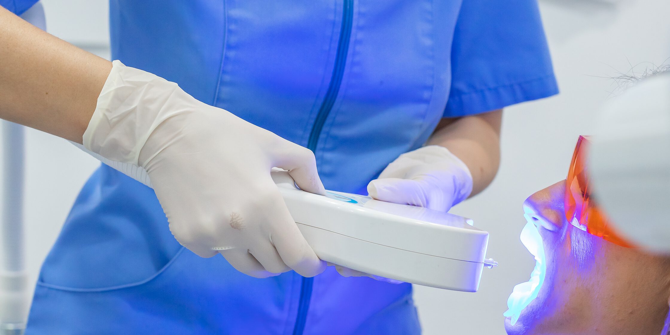 blanqueamiento dental en Burjassot – luz fría