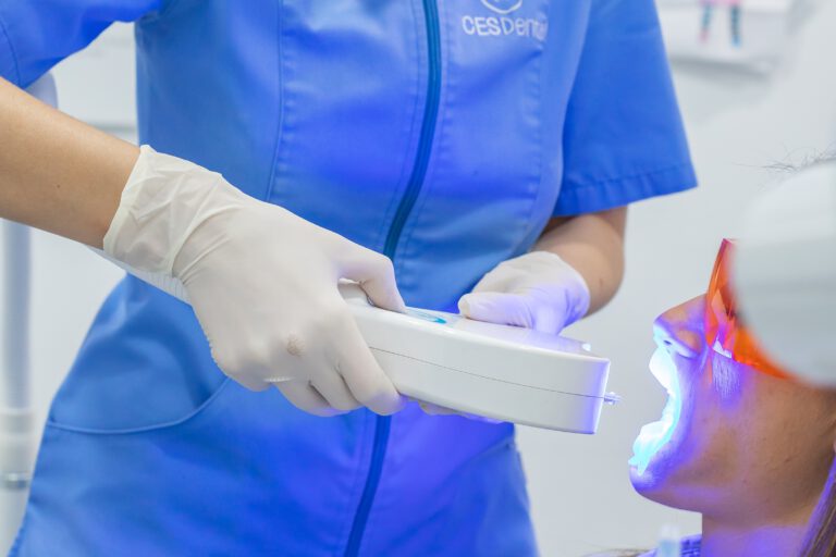 blanqueamiento dental en Burjassot – luz fría