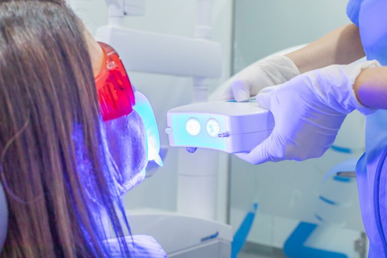 dentistas cerca de burjassot – blanqueamiento dental dentistas cerca de burjassot - blanqueamiento dental