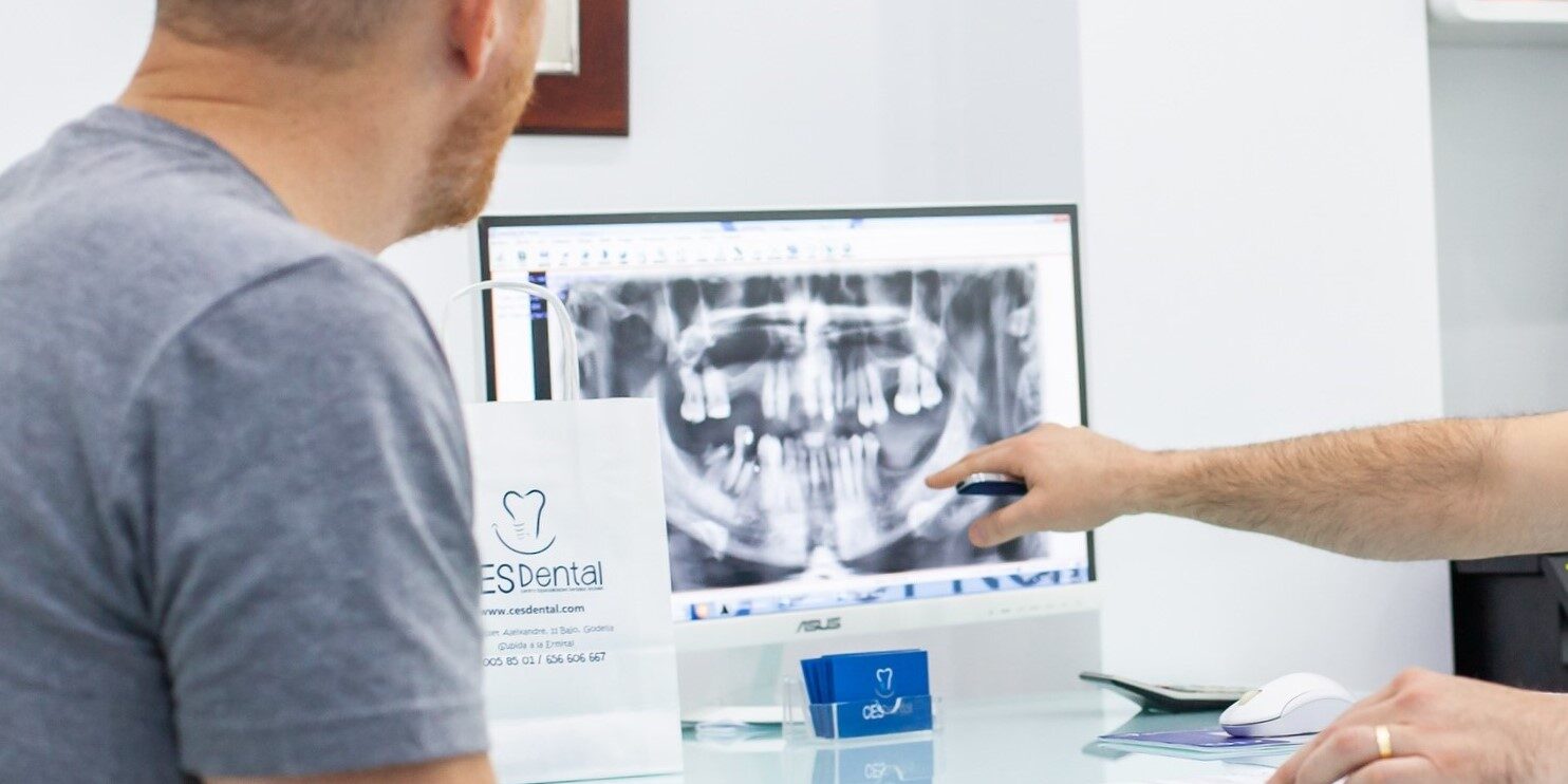 dentistas en burjassot - prótesis y carillas