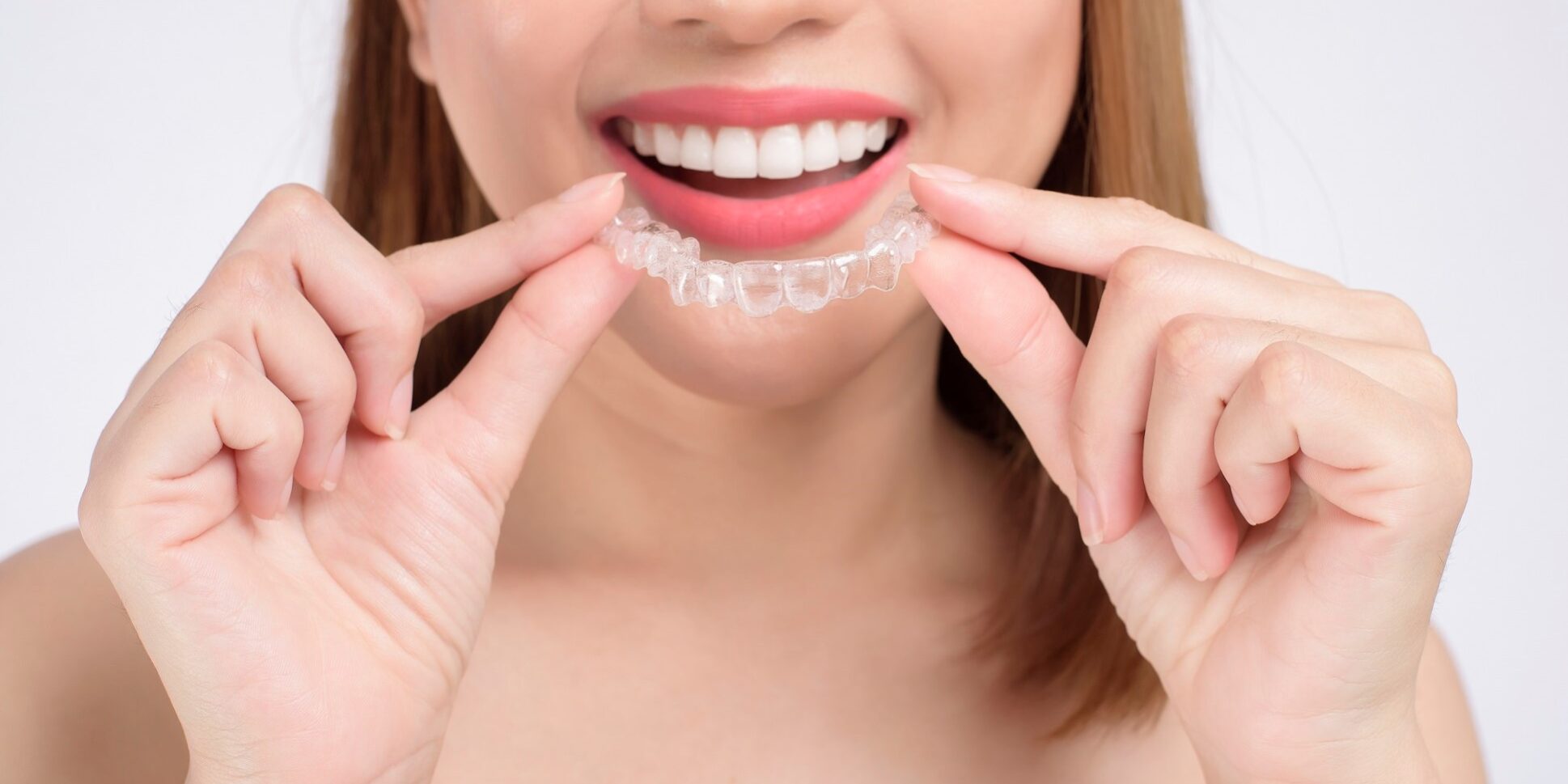ofertas de ortodoncia invisible en Burjassot - ferulas