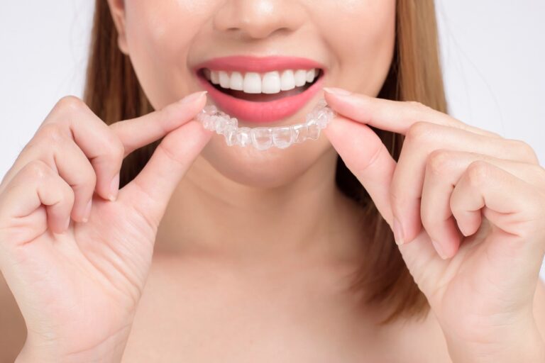 ofertas de ortodoncia invisible en Burjassot – ferulas ofertas de ortodoncia invisible en Burjassot - ferulas