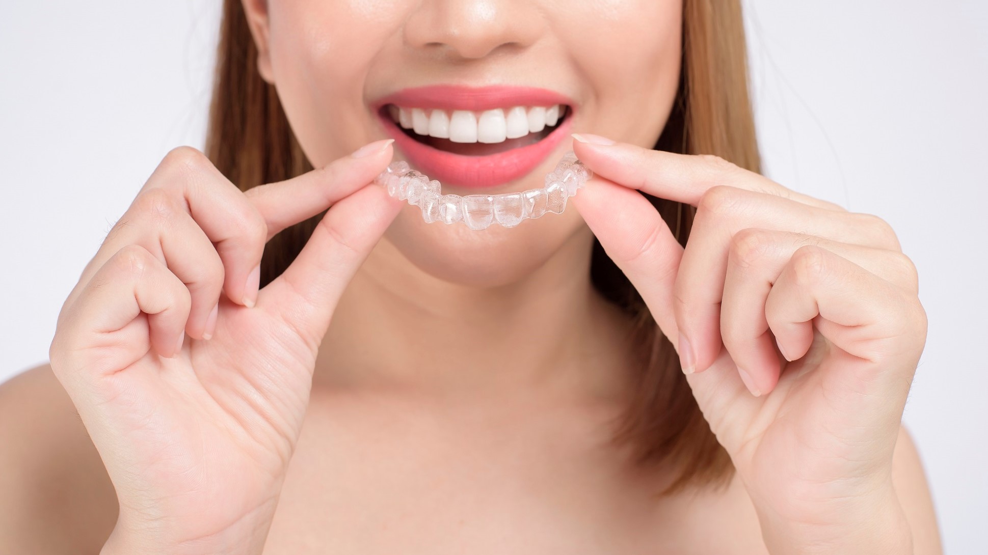 Descubre las ofertas de ortodoncia invisible en Burjassot de CES Dental