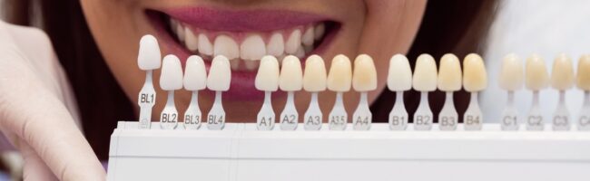 implantes con carga inmediata en Valencia - comparación