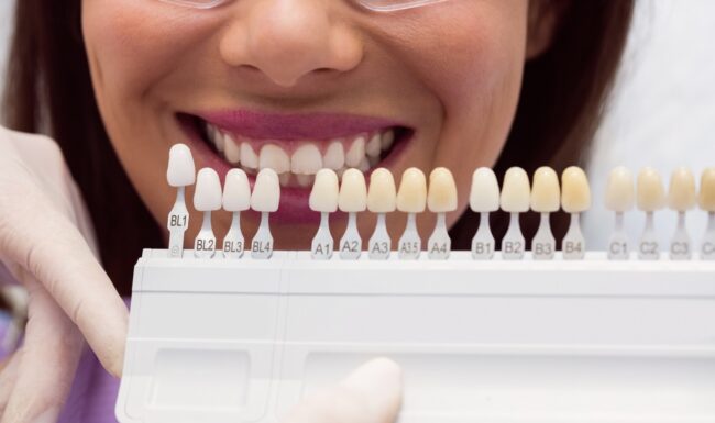 implantes con carga inmediata en Valencia - comparación