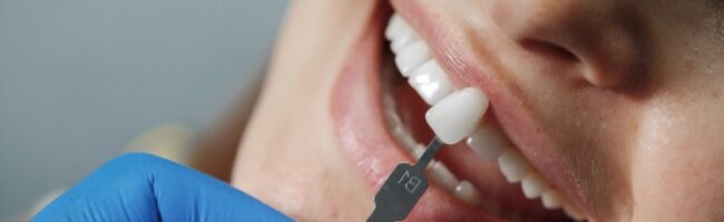 implantes con carga inmediata en Valencia - piezas dentales