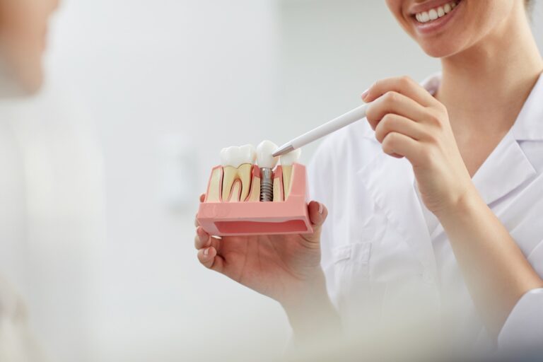 implantología inmediata en Valencia – modelo implantología inmediata en Valencia - modelo