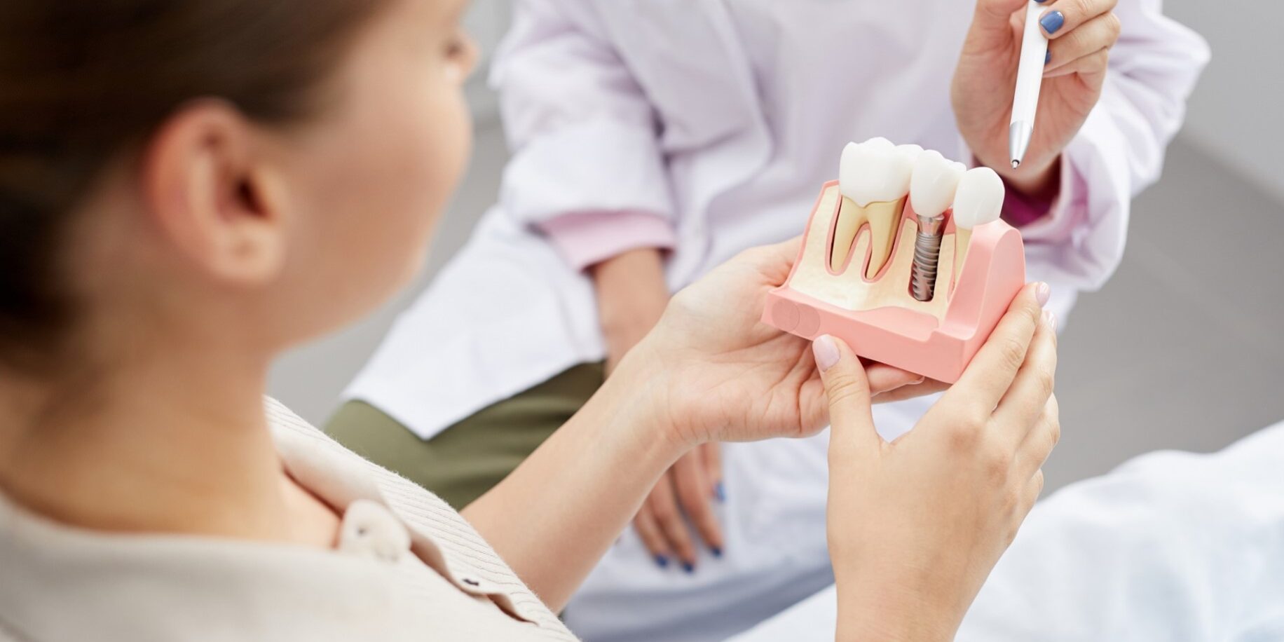 implante de carga inmediata Valencia - prótesis