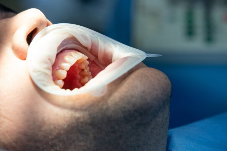 implantología inmediata en Valencia – operaciones implantología inmediata en Valencia - operaciones