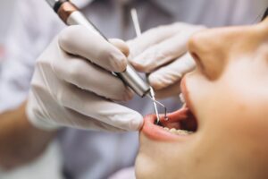 implante dental inmediato en valencia boca