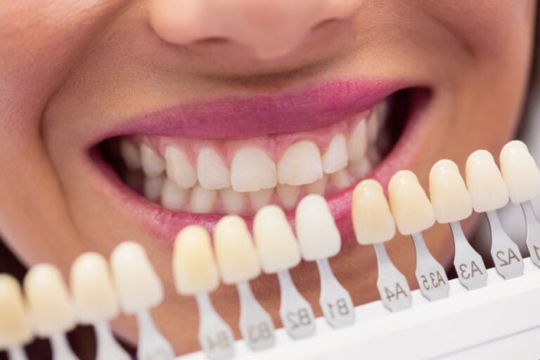 Implante de carga inmediata Valencia – Dientes Implante de carga inmediata Valencia - Dientes