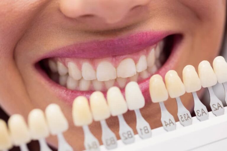 Implante de carga inmediata Valencia – Dientes Implante de carga inmediata Valencia - Dientes