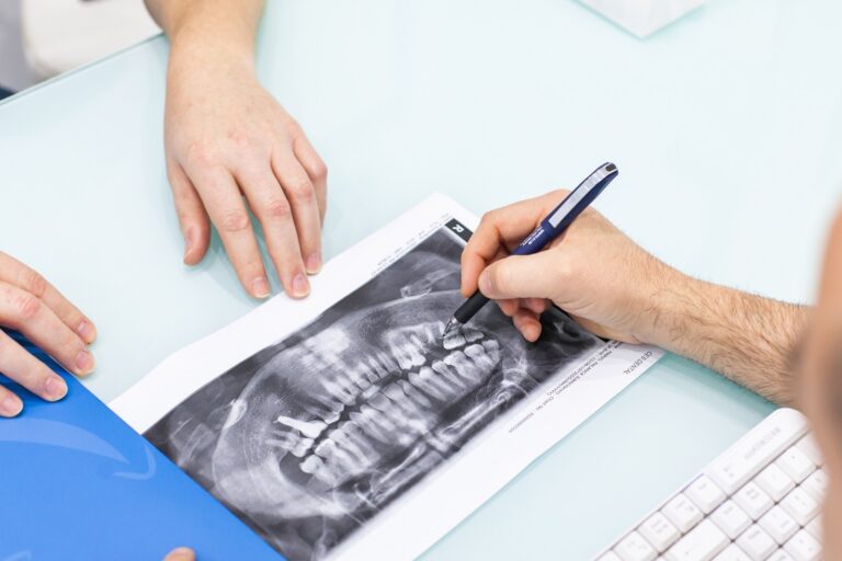 implantes fijos en Valencia – protesis 3d implantes fijos en Valencia - protesis 3d