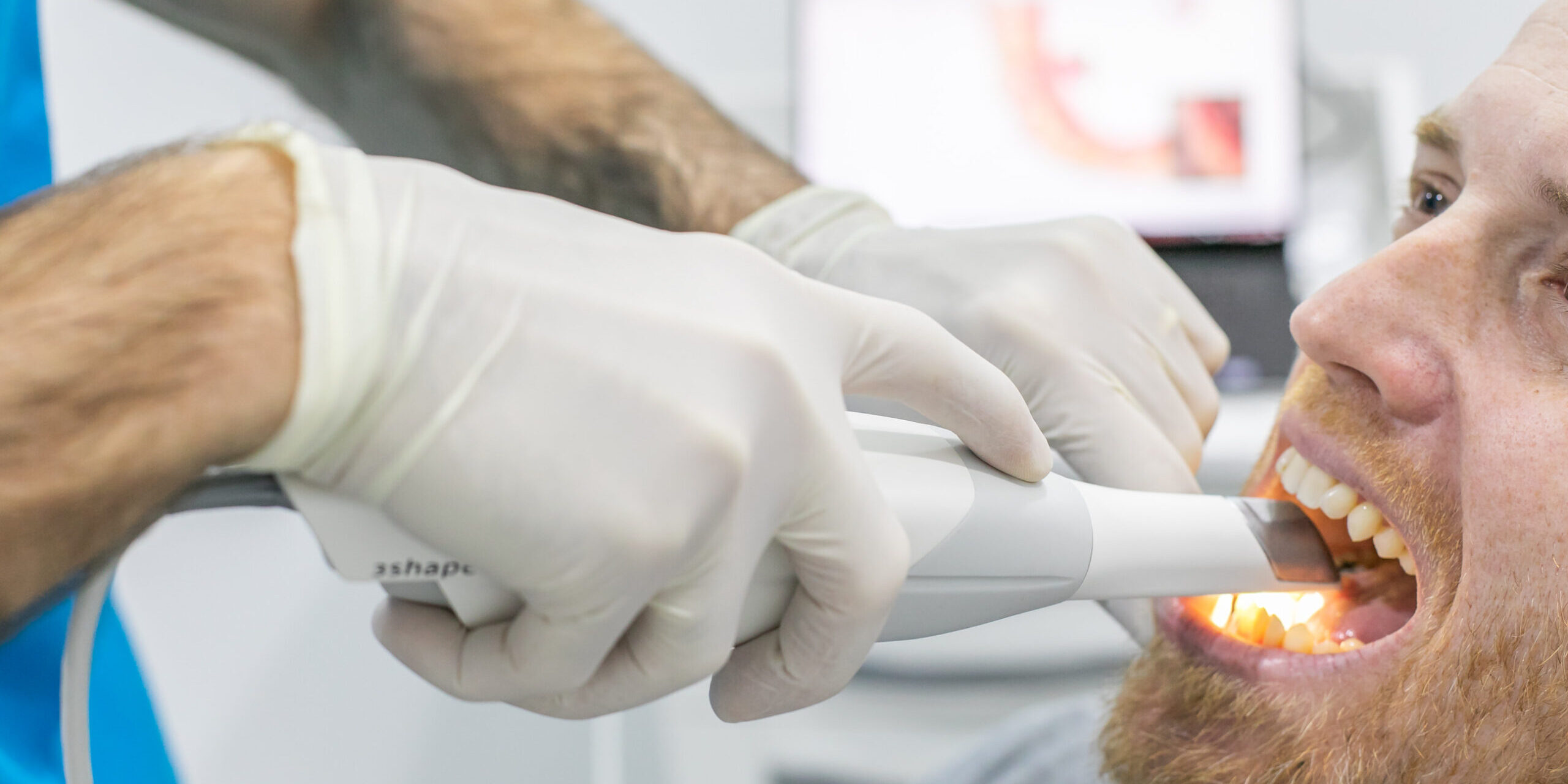 clinica dental cerca de Mas Camarena – boca clinica dental cerca de Mas Camarena - boca