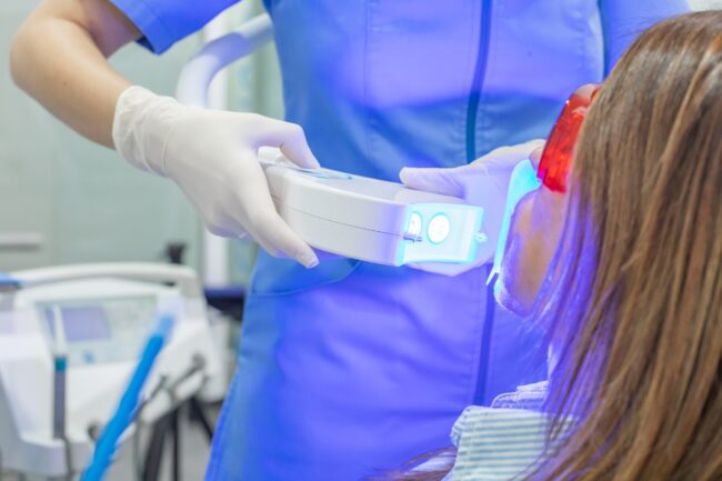 odontología estética en Bujassot - blanqueamiento dental