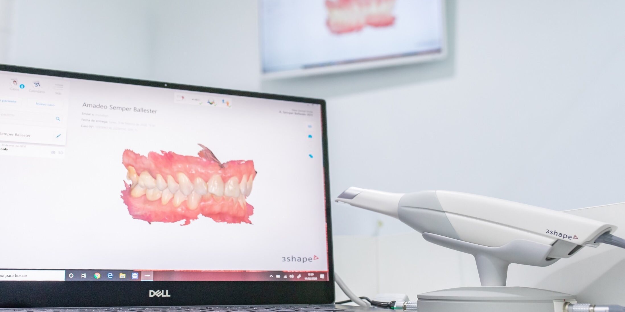 implante de diente inmediato en Valencia - ordenador