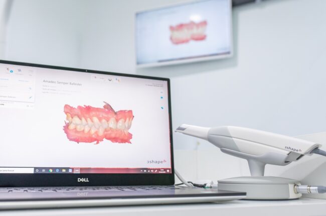 implante de diente inmediato en Valencia - ordenador