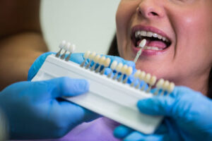 Implantes con carga inmediata en Valencia - Opciones