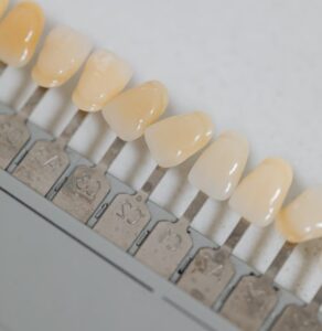 Implantología inmediata en Valencia - Dientes